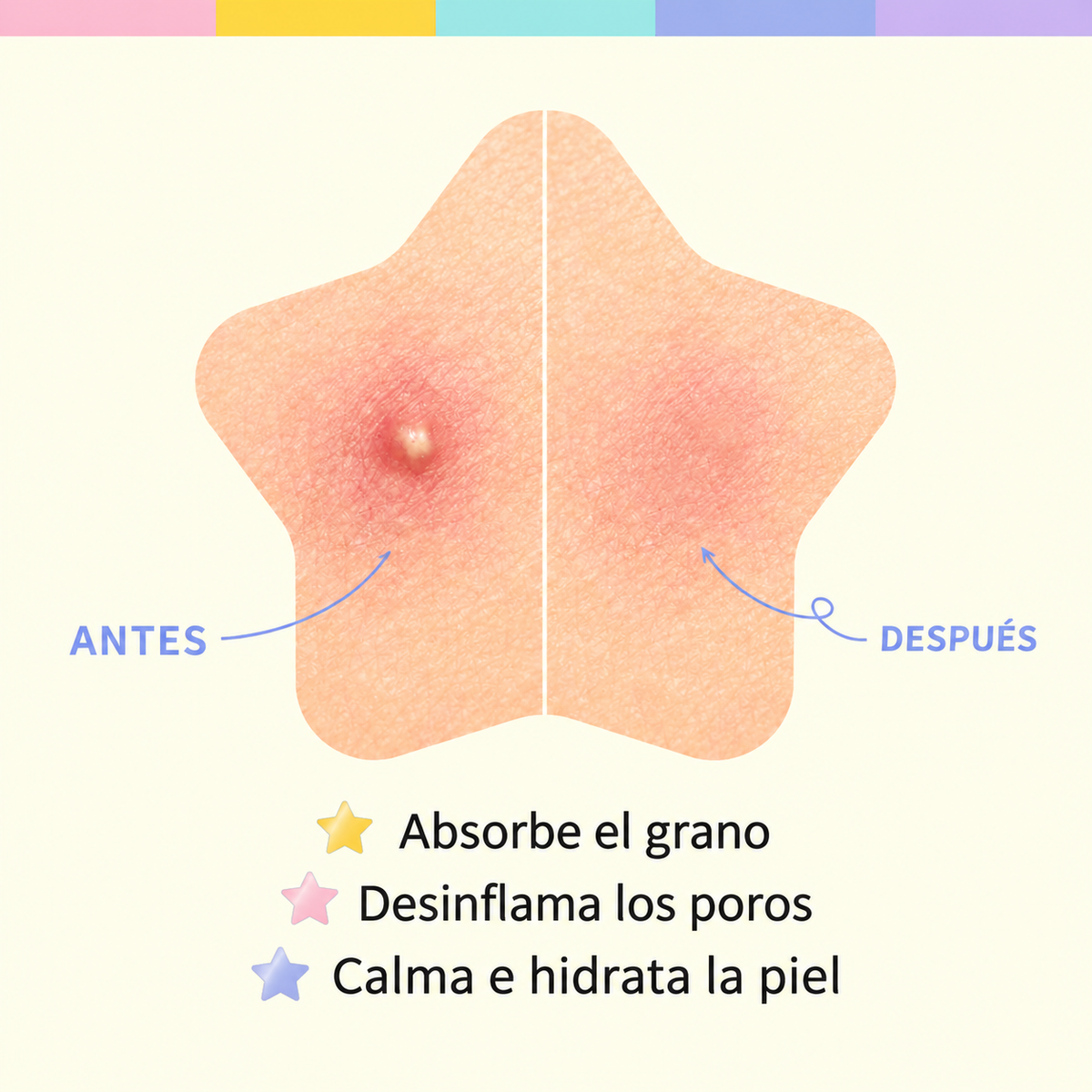 Star Spot Patch (80 patches)